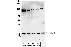 anti-Ribosomal Protein L12 (RPL12) (AA 115-165) antibody