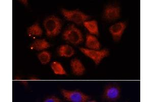 Immunofluorescence analysis of HeLa cells using HMGA1 Polyclonal Antibody at dilution of 1:100 (40x lens). (HMGA1 anticorps)