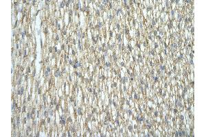 Rabbit Anti-HNRNPA2B1 antibody   Paraffin Embedded Tissue: Human Heart cell Cellular Data: cardiac cell of renal tubule Antibody Concentration: 4.