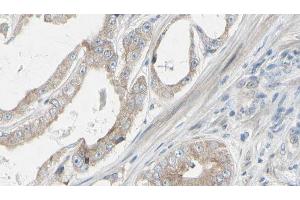 ABIN6272312 at 1/100 staining Human prostate tissue by IHC-P. (GRAP anticorps)