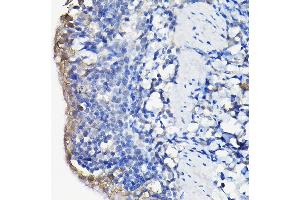 Immunohistochemistry of paraffin-embedded rat lung using Galectin 3/Galectin 3/LG Rabbit pAb (ABIN7267338) at dilution of 1:100 (40x lens).