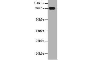 Western blot All lanes: NRG2 antibody at 16 μg/mL + U251 whole cell lysate Secondary Goat polyclonal to rabbit IgG at 1/10000 dilution Predicted band size: 92, 91, 93, 47, 46, 68, 71 kDa Observed band size: 92 kDa (Neuregulin 2 anticorps  (AA 112-405))