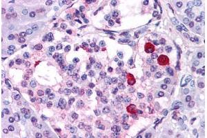 Anti-GIPR antibody  ABIN1048656 IHC staining of human pancreas. (GIPR anticorps  (N-Term))
