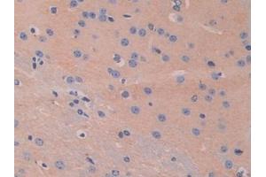 Detection of HEXb in Mouse Cerebrum Tissue using Polyclonal Antibody to Hexosaminidase B Beta (HEXb) (HEXB anticorps  (AA 294-435))