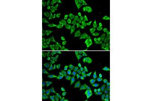 Immunofluorescence analysis of HeLa cell using DDX20 antibody. (DDX20 anticorps)