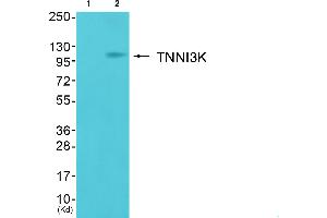 Western blot analysis of extracts from cos-7 cells (Lane 2), using TNNI3K Antibody. (TNNI3K anticorps  (Internal Region))
