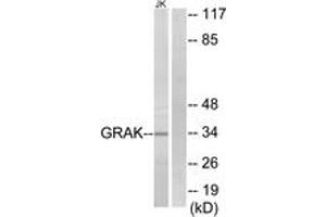 Western Blotting (WB) image for anti-Granzyme K (Granzyme 3, Tryptase II) (GZMK) (AA 61-110) antibody (ABIN2889995) (GZMK anticorps  (AA 61-110))