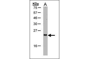 Western blot: Sample (30 µg of whole cell lysate). (ARL2 anticorps  (AA 123-184))
