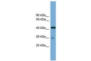 Image no. 1 for anti-Regulatory Factor X-Associated Protein (RFXAP) (AA 101-150) antibody (ABIN6744620)