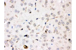 IHC testing of FFPE rat brain with CP antibody. (Ceruloplasmin anticorps  (AA 20-258))