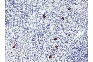 Immunohistochemical staining of paraffin-embedded Human tonsil using anti-RPS6KB1 mouse monoclonal antibody. (RPS6KB1 anticorps)