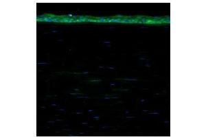 ALDH1A1 antibody used at a dilution of 1:200 to detect human cornea. (ALDH1A1 anticorps  (Middle Region))