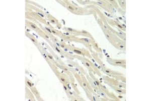 Immunohistochemistry of paraffin-embedded mouse heart using UPF1/RENT1 antibody  at dilution of 1:100 (40x lens). (RENT1/UPF1 anticorps  (AA 270-370))