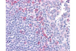 Immunohistochemistry (IHC) image for anti-delta-Like 1 (DLL1) (N-Term) antibody (ABIN2782684)