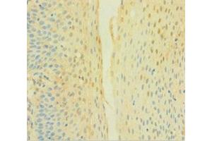 Immunohistochemistry of paraffin-embedded human tonsil tissue using ABIN7149094 at dilution of 1:100 (CYBB anticorps  (AA 283-570))
