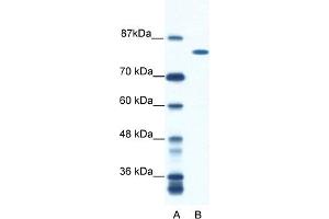 WB Suggested Anti-DHX16 Antibody Titration:  0. (DHX16 anticorps  (N-Term))