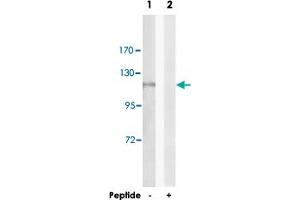 Western blot analysis of extracts from HeLa cells, using AOX1 polyclonal antibody . (AOX1 anticorps)