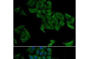 Immunofluorescence analysis of A549 cells using SMYD5 Polyclonal Antibody (SMYD5 anticorps)