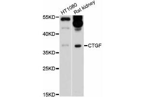 Western blot analysis of extracts of various cell lines, using CTGF antibody (ABIN5997528) at 1/1000 dilution. (CTGF anticorps)
