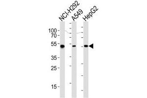 Western blot analysis of lysate from NCI-H292, A549, HepG2 cell line (left to right) using ALDH2 antibody at 1:1000 for each lane. (ALDH2 anticorps)