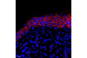 Immunofluorescent analysis of paraffin embedded rat bladder using PMCA1 (ABIN7073155) at dilution of 1: 500