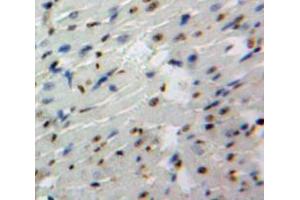 Used in DAB staining on fromalin fixed paraffin-embedded Heart tissue (GATA4 anticorps  (AA 201-442))