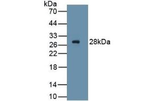 WB of Protein Standard: different control antibodies against Highly purified E. (PDGFRA Kit ELISA)