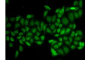 Immunofluorescence (IF) image for anti-Ataxin 1 (ATXN1) antibody (ABIN1882344)