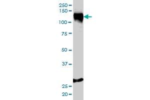 STAG1 monoclonal antibody (M01), clone 2E9 Western Blot analysis of STAG1 expression in HeLa .