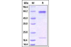 Biotinylated Mouse PCSK9 on SDS-PAGE under reducing (R) condition.