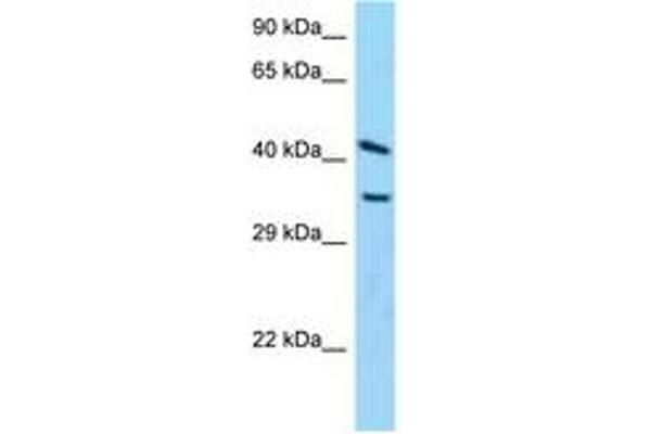 ADPRH antibody  (C-Term)