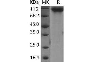 Western Blotting (WB) image for V-Erb-A erythroblastic Leukemia Viral Oncogene Homolog 4 (Avian) (ERBB4) (Active) protein (His tag) (ABIN7320059) (ERBB4 Protein (His tag))