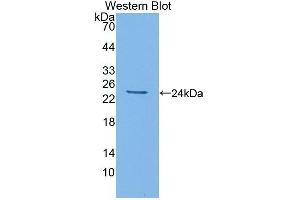 Detection of Recombinant IL6, Rat using Monoclonal Antibody to Interleukin 6 (IL6) (IL-6 anticorps  (AA 21-211))