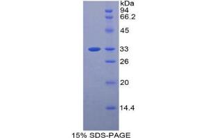 SDS-PAGE analysis of Mouse BST1 Protein.