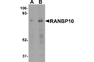 Western Blotting (WB) image for anti-RAN Binding Protein 10 (RANBP10) (Middle Region) antibody (ABIN1031052)