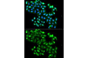 Immunofluorescence analysis of A549 cells using PHF11 antibody (ABIN5975729). (PHF11 anticorps)