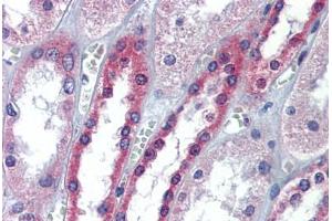 Human Kidney: Formalin-Fixed, Paraffin-Embedded (FFPE)