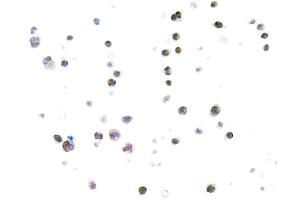 Immunocytochemistry (ICC) image for anti-Thymus High Mobility Group Box Protein (TOX) (AA 50-100) antibody (ABIN7453374) (Recombinant TOX anticorps  (AA 50-100))