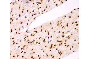 Immunohistochemistry of paraffin-embedded Human colon using TEAD3 Polyclonal Antibody at dilution of 1:100 (40x lens). (TEAD3 anticorps)