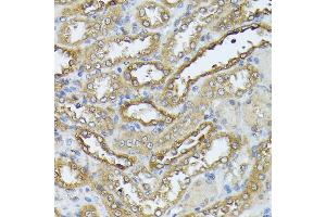 Immunohistochemistry of paraffin-embedded rat kidney using D antibody (ABIN7266712) at dilution of 1:100 (40x lens). (DAPK3 anticorps  (AA 1-100))