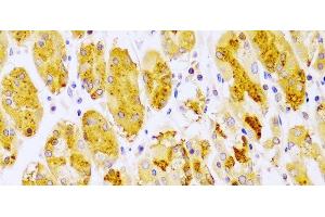 Immunohistochemistry of paraffin-embedded Human stomach using PRKCE Polyclonal Antibody at dilution of 1:100 (40x lens). (PKC epsilon anticorps)
