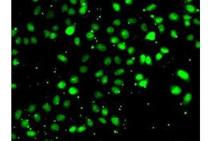 Immunofluorescence analysis of HeLa cells using NUDT2 antibody. (NUDT2 anticorps  (AA 1-147))