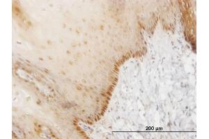 Immunoperoxidase of monoclonal antibody to HOXB7 on formalin-fixed paraffin-embedded human esophagus.