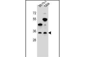GPM6B anticorps  (N-Term)