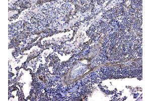 IHC analysis of GSTM3 using anti-GSTM3 antibody .