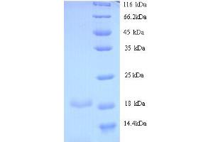 SDS-PAGE (SDS) image for Betacellulin (BTC) (AA 32-178) protein (His tag) (ABIN5713288)