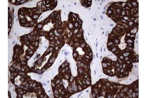 Immunohistochemistry (IHC) image for anti-Keratin Acidic (AE1) antibody (ABIN2715666)