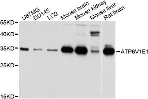 Western blot analysis of extracts of various cell lines, using ATP6V1E1 antibody. (ATP6V1E1 anticorps)
