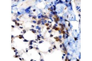 IHC analysis of VAPB using anti-VAPB antibody (ABIN5693292). (VAPB anticorps  (AA 2-55))