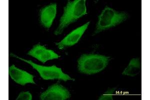 Immunofluorescence of monoclonal antibody to ATP6V1A on HeLa cell.